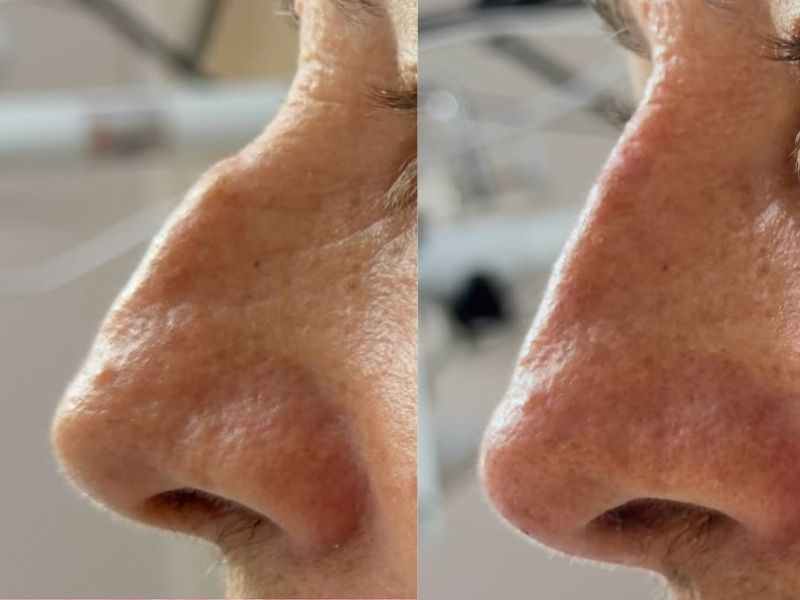 Aesthetic treatment result